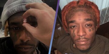 Lil Uzi Vert Says Fans Ripped $24M ‘Vision’ Diamond From His Forehead Know The More Details
