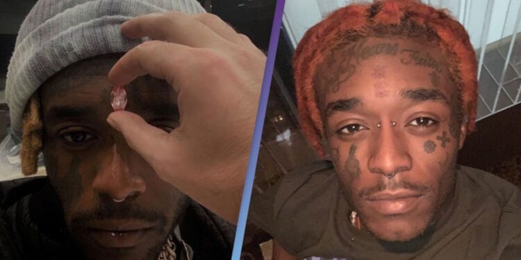 Lil Uzi Vert Says Fans Ripped $24M ‘Vision’ Diamond From His Forehead Know The More Details