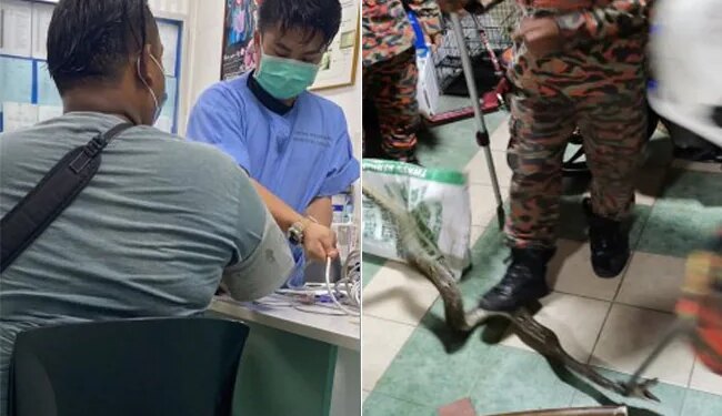 Was Playing VIDEO Game Sitting In The Toilet, Snake Bitten From Behind, Pieces Of Snakes Teeth Came Out After Two Weeks