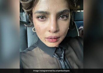 After Seeing This Picture Of Priyanka Chopra, The Fans Got Worried, Said- You Are Fine, Priyanka! – प्रियंका चोपड़ा की इस तस्वीर को देखने के बाद फैंस को हुई चिंता, कहा