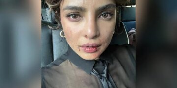 After Seeing This Picture Of Priyanka Chopra, The Fans Got Worried, Said- You Are Fine, Priyanka! – प्रियंका चोपड़ा की इस तस्वीर को देखने के बाद फैंस को हुई चिंता, कहा