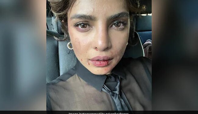 After Seeing This Picture Of Priyanka Chopra, The Fans Got Worried, Said- You Are Fine, Priyanka! – प्रियंका चोपड़ा की इस तस्वीर को देखने के बाद फैंस को हुई चिंता, कहा