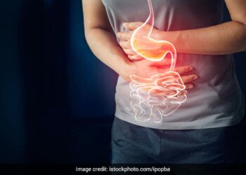 Yoga For Acidity, Constipation, Gas: Which Yoga Is Best For Instant Relief From Acidity And Constipation