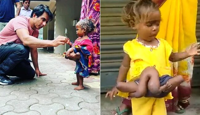 Sonu Sood Will Get Treatment For Chaumukhi Kumari, A Unique Girl With Four Hands And Four Legs From Bihar