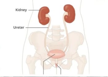 Sir Ganga Ram Hospital Did Wonders By Removing The Patients Left Kidney And Transplanting It On The Right Side