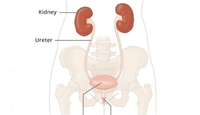 Sir Ganga Ram Hospital Did Wonders By Removing The Patients Left Kidney And Transplanting It On The Right Side