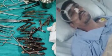यूपी : मुजफ्फरनगर में एक शख्स के पेट से निकले स्टील के 63 चम्मच, पूरा मामला बना हुआ है संशय