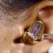 Dangerous Snake Video: Snake Inside The Ear Small Snake Inside The Ear Shocking Footage Viral On Facebook | Snake Entered The Girl Ear