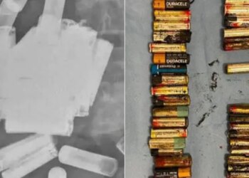 Woman Ate 55 Batteries: Ireland Doctors Successfully Remove 55 Batteries From Woman Gut And Stomach