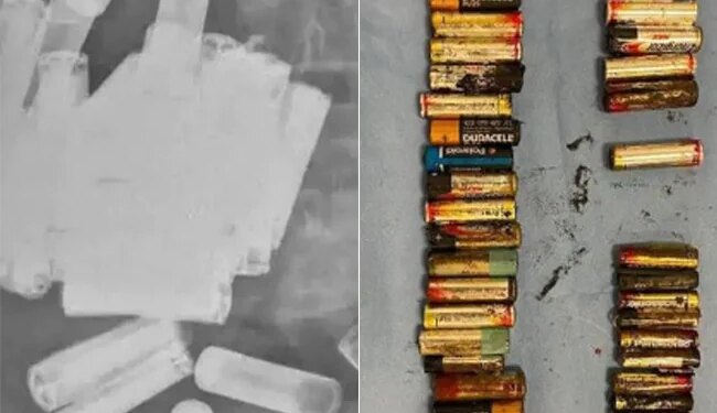 Woman Ate 55 Batteries: Ireland Doctors Successfully Remove 55 Batteries From Woman Gut And Stomach