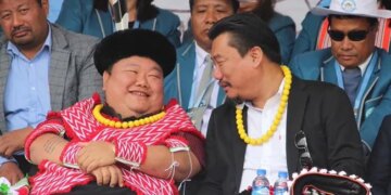 Life Is Short And Smile While You Still Have Teeth Says Nagaland Minister Temjen Imna