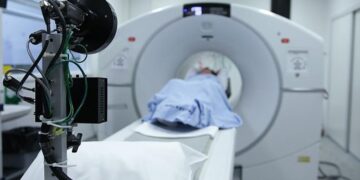 दिल्ली के अस्पताल में एक व्यक्ति की थाइरॉयड ग्रंथि से निकाला गया "नारियल के आकार" का ट्यूमर