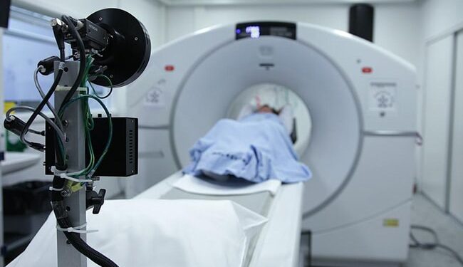 दिल्ली के अस्पताल में एक व्यक्ति की थाइरॉयड ग्रंथि से निकाला गया "नारियल के आकार" का ट्यूमर