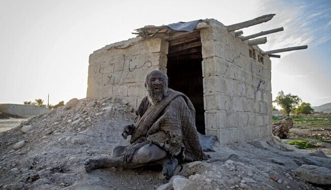 Worlds Dirtiest Man Who Died After First Bath In 60 Years: Report