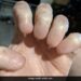 Hand Without Nails Viral Image Of A Man Hand Without Nails Shocks The Internet