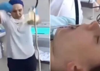 Snake In Mouth: Viral Video Of 4 Feet Long Snake Entered In Woman Mouth In Russia Doctors Take It Out Surgically