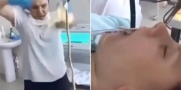 Snake In Mouth: Viral Video Of 4 Feet Long Snake Entered In Woman Mouth In Russia Doctors Take It Out Surgically