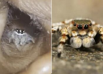 Spider Inside Ear Of Indian Woman: Spider Crawls Out Of A Womans Ear In Shocking Viral Video