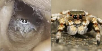 Spider Inside Ear Of Indian Woman: Spider Crawls Out Of A Womans Ear In Shocking Viral Video