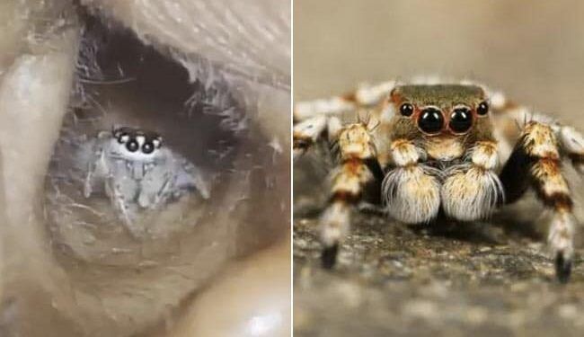 Spider Inside Ear Of Indian Woman: Spider Crawls Out Of A Womans Ear In Shocking Viral Video