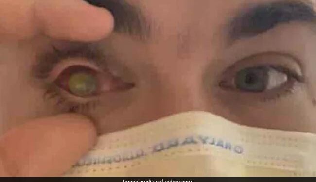 OMG, One Eye Of The Boy Disappeared Overnight, He Slept In A Deep Sleep, The Eye Was Not There In The Morning Ndtv Hindi Ndtv India