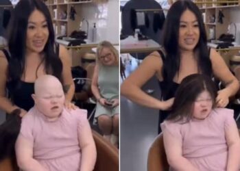 So Beautiful So Brav: Little Girl With Down Syndrome And Alopecia Gets A New Gift | Child With Alopecia And Down Syndrome Smiles Brightly As She Gets A Wig On Her Head