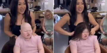 So Beautiful So Brav: Little Girl With Down Syndrome And Alopecia Gets A New Gift | Child With Alopecia And Down Syndrome Smiles Brightly As She Gets A Wig On Her Head