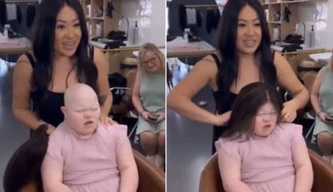 So Beautiful So Brav: Little Girl With Down Syndrome And Alopecia Gets A New Gift | Child With Alopecia And Down Syndrome Smiles Brightly As She Gets A Wig On Her Head