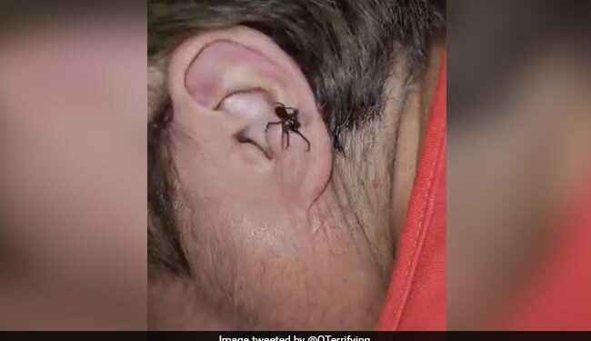 Live Spider Crawling Out Of A Man Ear You Will Get Goosebumps Watch Hair Raising Video