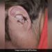 Live Spider Crawling Out Of A Man Ear You Will Get Goosebumps Watch Hair Raising Video